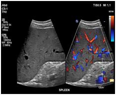 Ultrasound of the Abdomen3